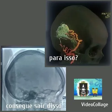 X-ray and Medical Scan of Skull