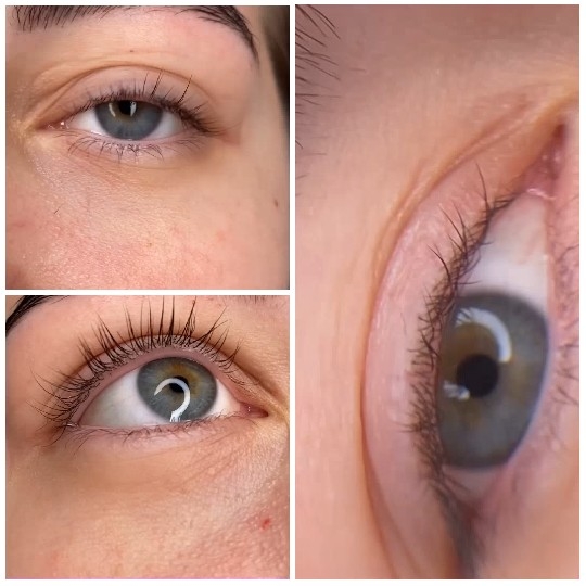Close-Ups of Human Eye