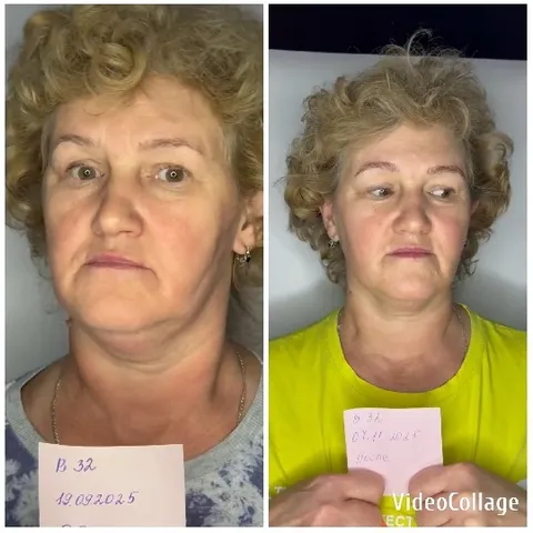 Comparison of Styles and Expressions