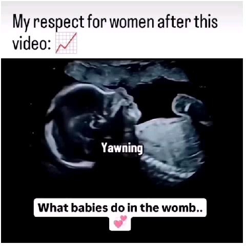 Ultrasound Scan of Yawning Baby