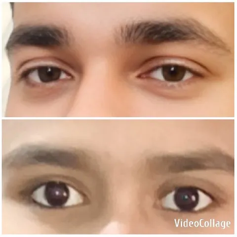 Close-Up of Human Eyes