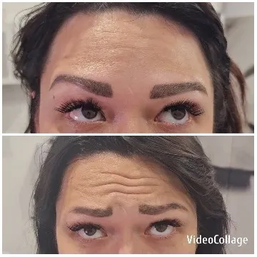 Close-Up of Forehead Expressions