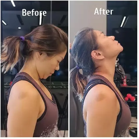 Posture Improvement Before and After