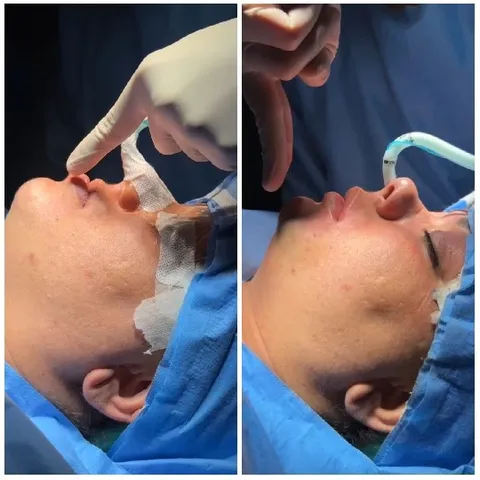Medical Setting with Surgical Draping