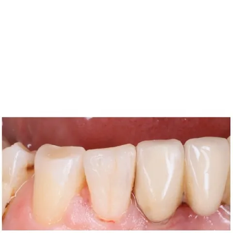 Close-Up of Healthy Teeth