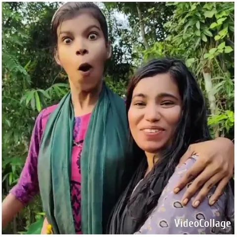 Surprised Expression in Nature