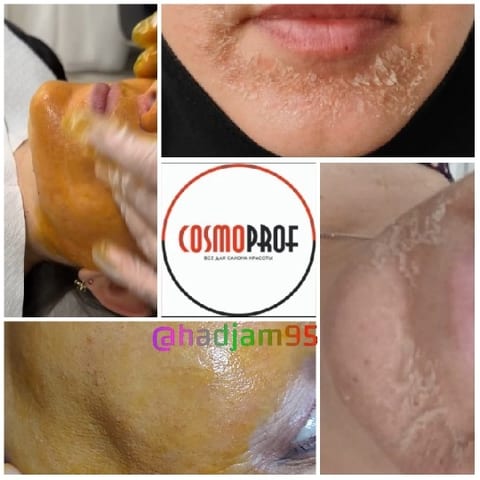 Stages of Skincare Treatment Process
