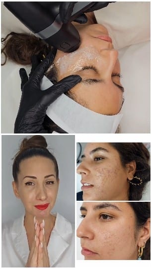 Skincare Treatment and Smiles