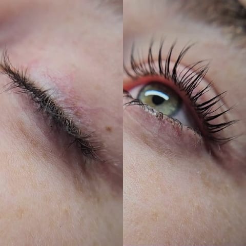 Close-Up Views of an Eye