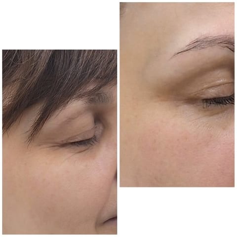 Close-Up Comparison of Eyes
