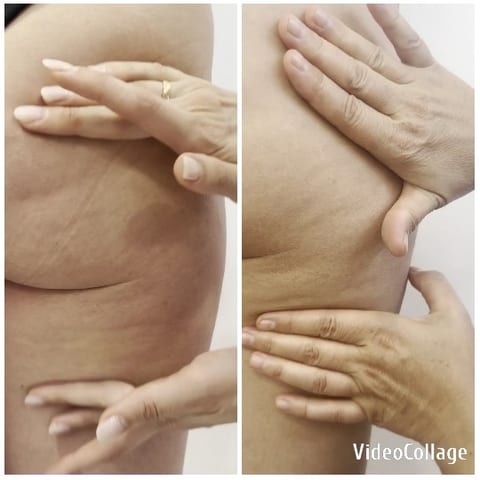 Skin Texture Demonstration