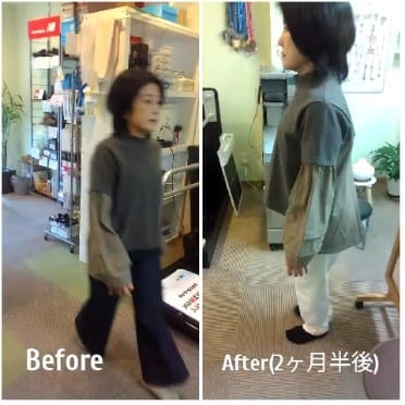 Before and After Home Setting