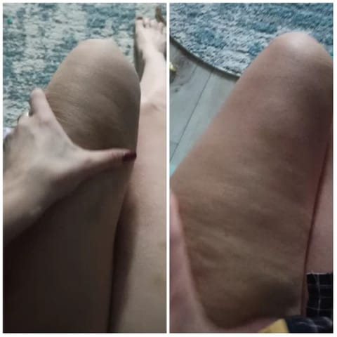 Thigh Comparison and Detail