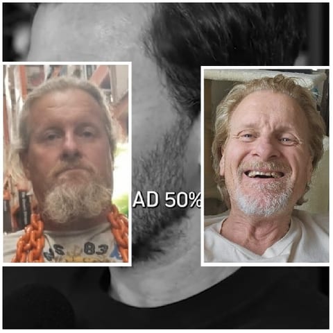 Man with Beard in Two Settings