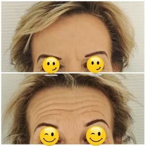 Skin Comparison: Smooth vs Wrinkled