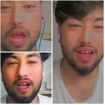 Man with Beard in Various Poses