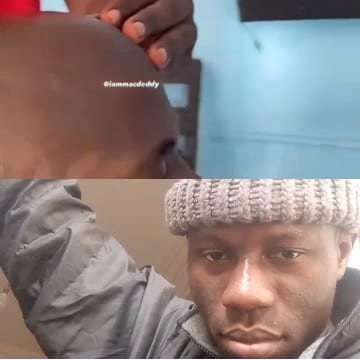 Touching Heads and Knit Hat Close-Up