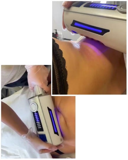 Cosmetic Procedure with Blue Light