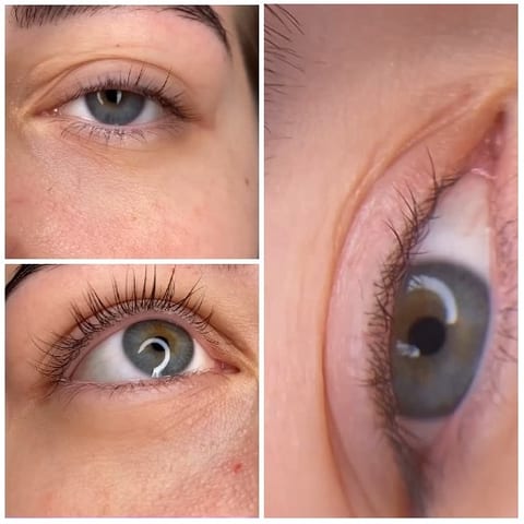 Close-Ups of Human Eye
