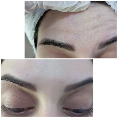 Close-up of Forehead and Eyebrows