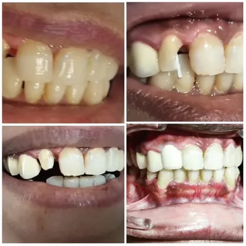 Dental Conditions and Treatments