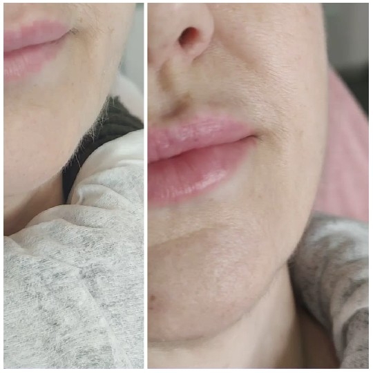 Close-Up of Lips and Fabric