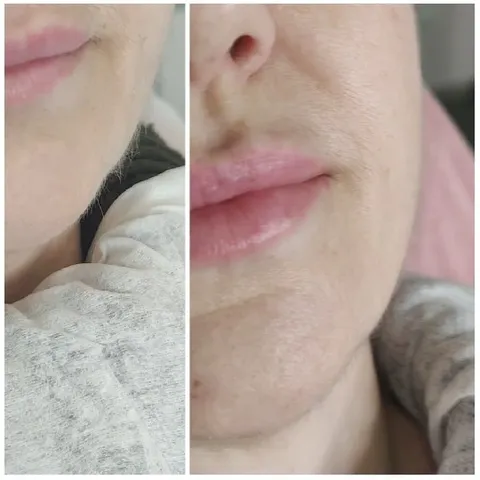 Close-Up of Lips and Fabric
