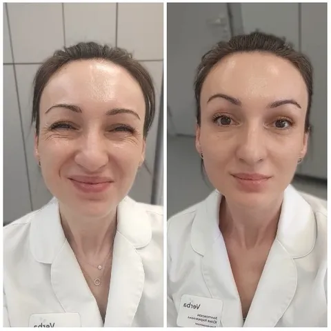 Smiling Woman in White Coat