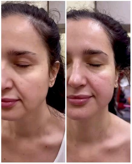 Before and After Skincare Comparison