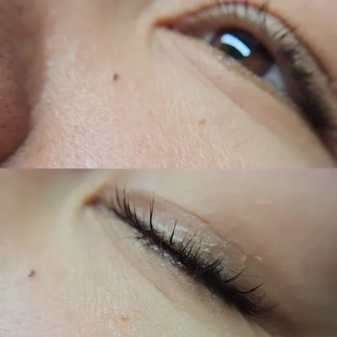 Close-Up of an Open and Closed Eye