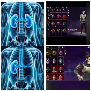 Medical Illustrations and Video Game Interface