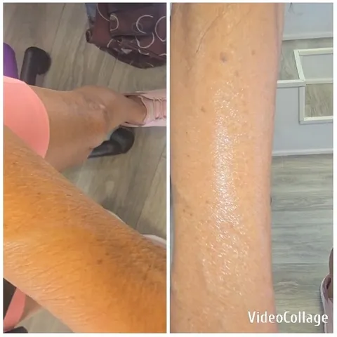 Close-Ups of Arm and Leg