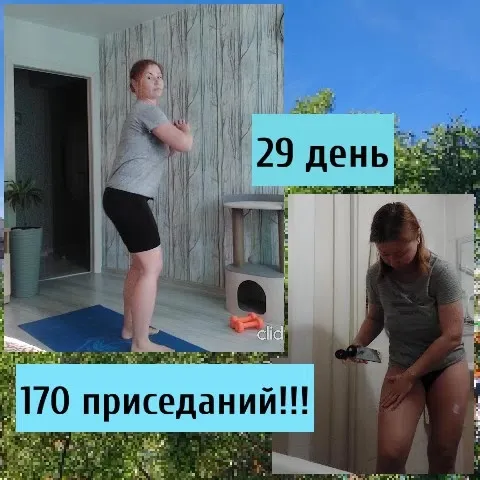Yoga Pose and Leg Treatment