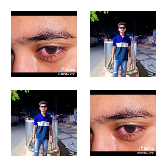 Close-Ups of Red Eyes