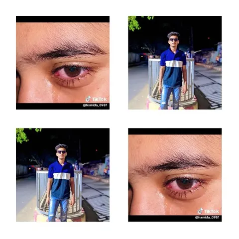 Close-Ups of Red Eyes