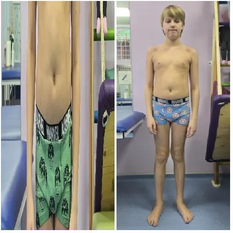 Split-Screen of Young Boy