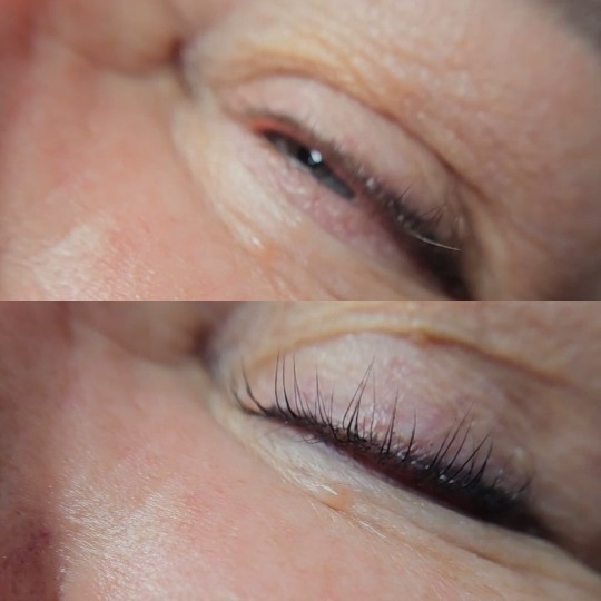 Close-Up of Two Eyes