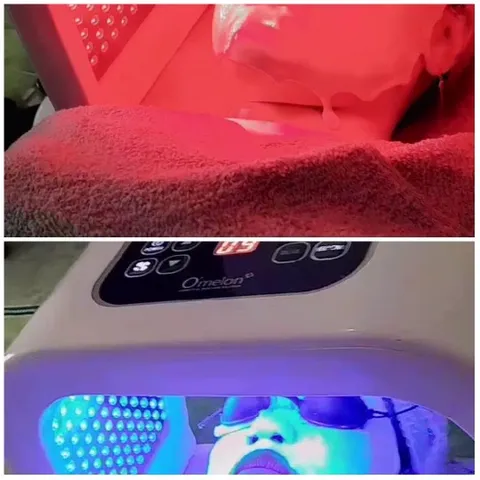 Facial Therapy Under Red and Blue Lights